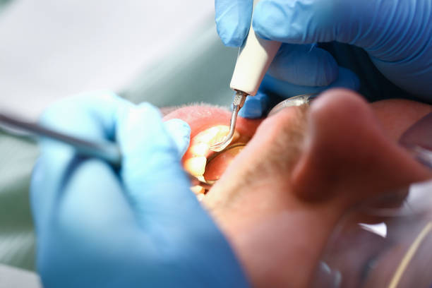 Best Pediatric Emergency Dentist in Lago Vista, TX
