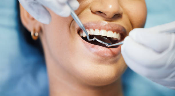 Best Emergency Gum Treatment in Lago Vista, TX