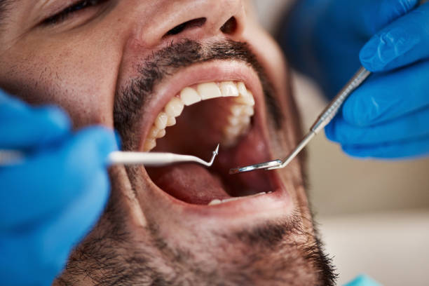 Best Emergency Dental Care for Broken or Chipped Teeth in Lago Vista, TX